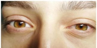 Стретчинг ресниц и бровей что это