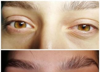 Стретчинг ресниц и бровей что это