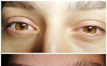 Стретчинг ресниц и бровей что это